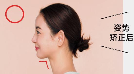 学会这几个动作 预防嘴角的皮肤松弛插图6