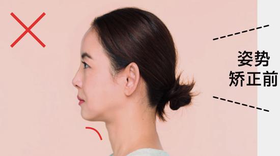学会这几个动作 预防嘴角的皮肤松弛插图5